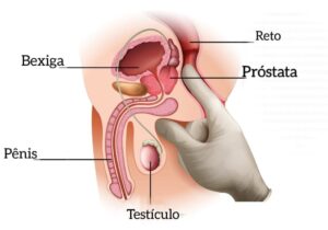 Exame de Toque Retal Próstata